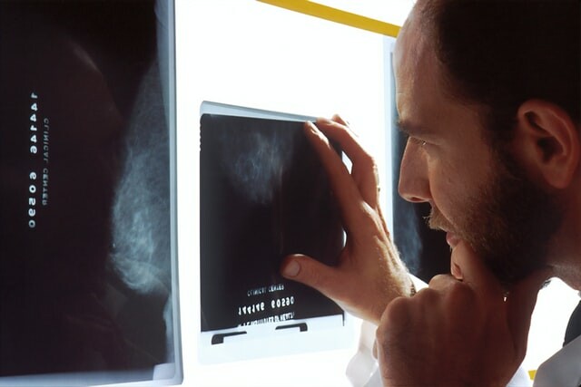 Diagnosefehler - Arzt schaut auf Röntgenbild